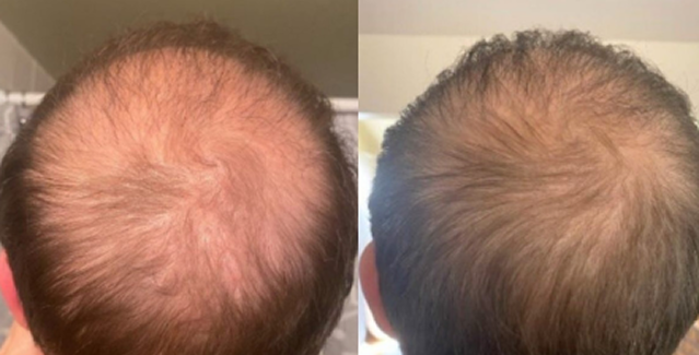 Before and after case 1
