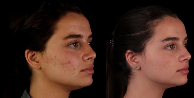 Before and after case 2