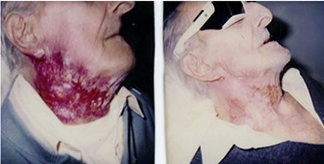 Before and after case 2