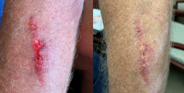 Before and after case 1
