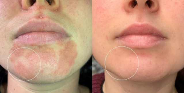 Before and after case 1