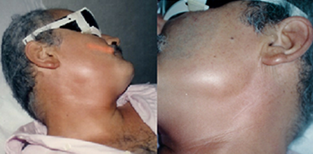 Before and after case 1