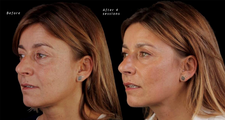 Before and after case 1