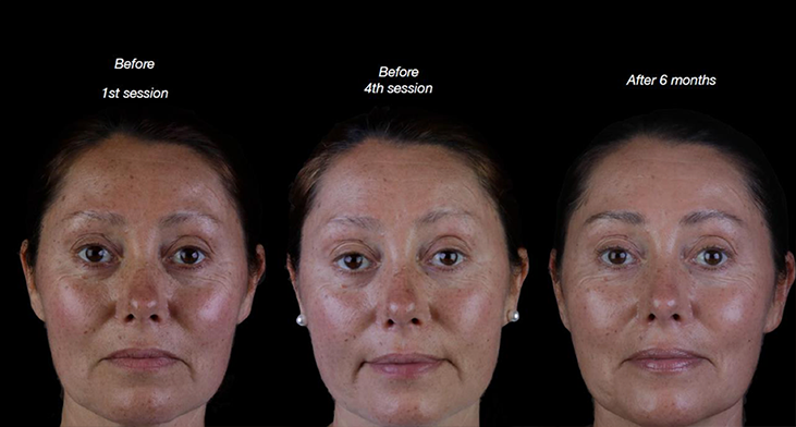 Before and after case 2
